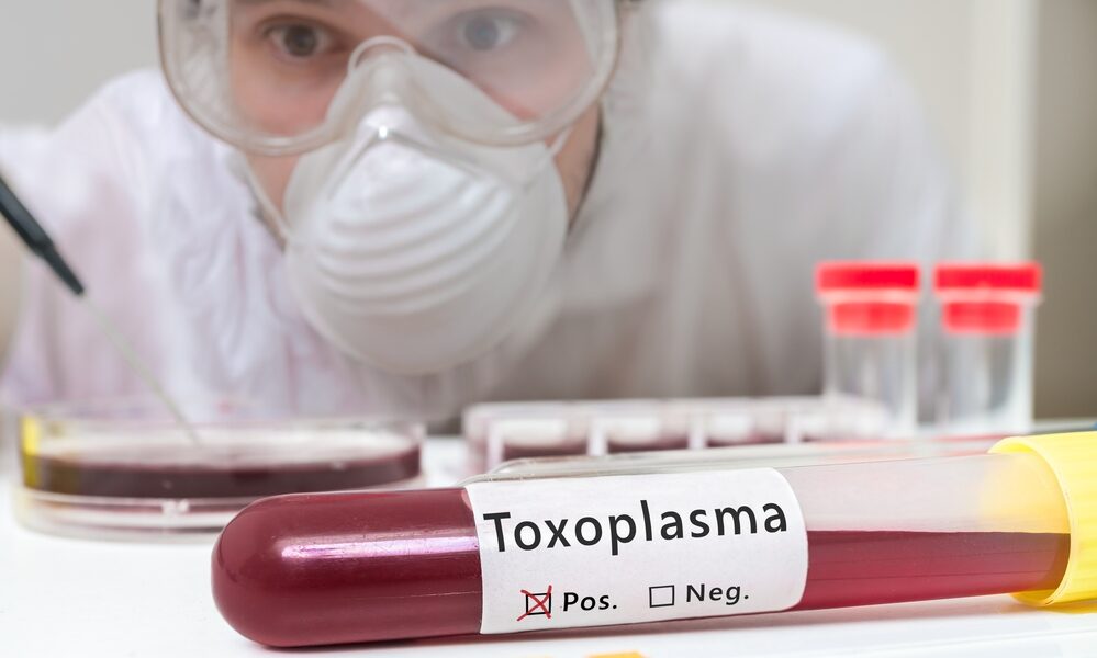 Toxoplasmosi: cos'è, sintomi e trattamento