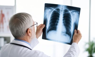 Medico con radiografia