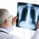 Medico con radiografia