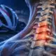 Illustrazione editoriale della parte alta della colonna vertebrale con un tenue accento luminoso sulle vertebre cervicali inferiori e toraciche superiori; sullo sfondo si intravede un casco da ciclismo.