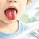 Illustrazione editoriale di un dettaglio anonimo della bocca di un bambino e di un blister farmaceutico separato su fondo chiaro.