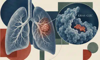 Polmoni stilizzati con un nodulo e un ingrandimento della proteina KRAS G12C accanto a un elemento geometrico arancione.