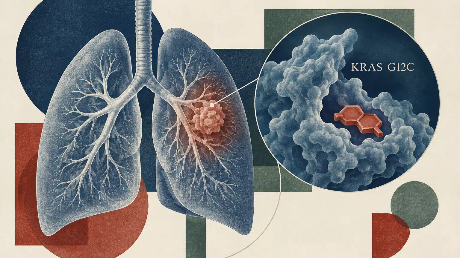 Polmoni stilizzati con un nodulo e un ingrandimento della proteina KRAS G12C accanto a un elemento geometrico arancione.
